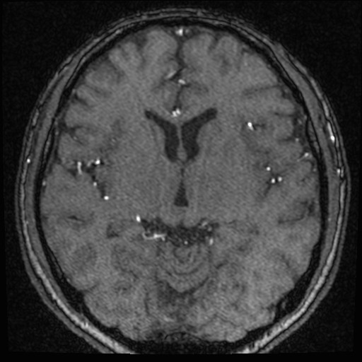 Click on the Serie image to view the images of VILLANUEVA, WILLIAM A.